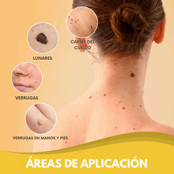 Spray Bee Venom – Elimina verrugas de forma segura, sin dolor ni cicatrices