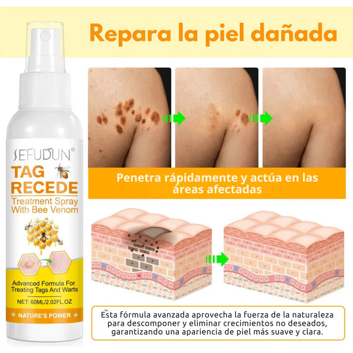 Spray Bee Venom – Elimina verrugas de forma segura, sin dolor ni cicatrices