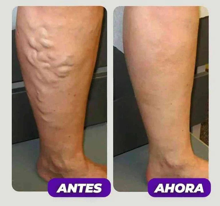 Rodillera Larga de Compresión - RODIFLEX