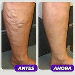 Rodillera Larga de Compresión - RODIFLEX